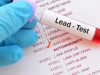 lead test tube